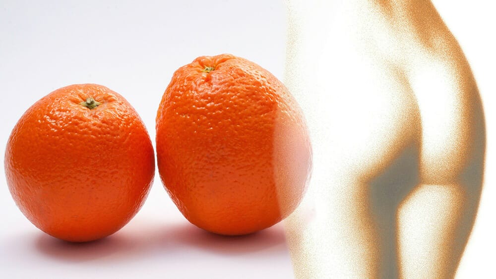 Comment éliminer la cellulite pour de bon