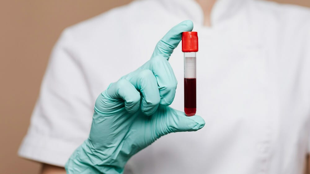 cholesterol hdl